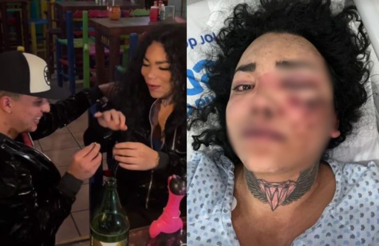 Paola Suárez revela desde el hospital que ya denunció a su novio tras golpearla luego de proponerle matrimonio