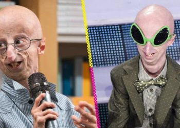 Muere a los 28 años Sammy Basso, científico que buscaba cura para su envejecimiento prematuro