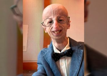 Murió a los 28 años el italiano que estudió el envejecimiento relámpago