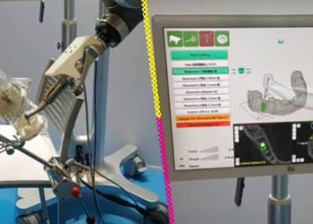 Yakebot, el primer robot dentista que hace cirugías con “precisión absoluta”