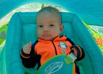 Bebé de 4 Meses Recibe Operación de Riñón Gracias a 120 Donaciones