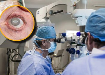 Gobierno federal anuncia cirugías de cataratas gratis: así es el registro