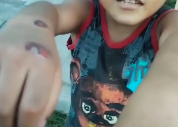 Niño Rescatado tras Ser Quemado por su Padre en Playa del Carmen