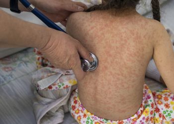 Sarampión en Europa está a su nivel máximo en más de 25 años