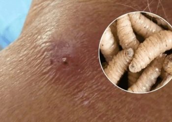 «México enfrenta crisis por gusano barrenador: detectan más de 400 brotes activos»