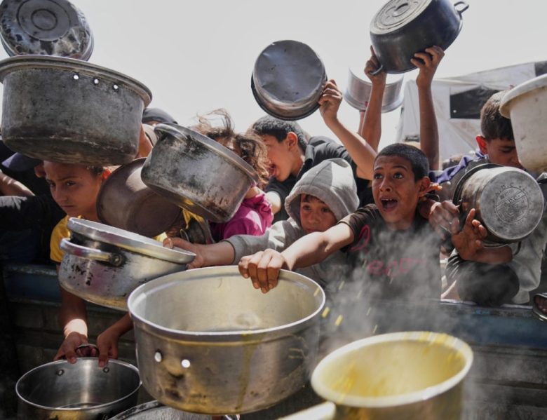 Ahmed El-Sheikh Eid, de 7 años, que presenta señales de desnutrición, en la Franja de Gaza