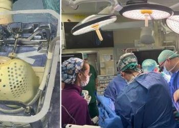 Trasplante de corazón artificial revoluciona la medicina en Israel