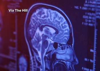 Uso de ChatGPT podría afectar el pensamiento crítico, revela estudio del MIT