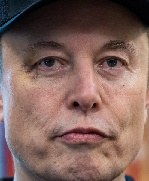 El magnate Elon Musk, con un moretón cerca del ojo derecho