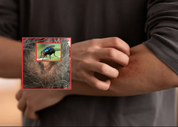 Ya son 13 personas enfermas por el gusano “devorador de hombres”. Quintana Roo confirma su primer caso de miasis