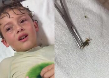 Un cangrejo en el oído. La inusual experiencia de un niño en Cancún