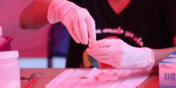 Alerta Sanitaria en Nuevo Laredo: Octubre Registra el Mayor Pico de Casos de VIH en 2025