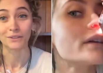Paris Jackson confiesa las secuelas del abuso de drogas y revela el daño permanente en su nariz
