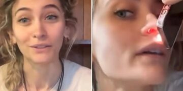 Paris Jackson confiesa las secuelas del abuso de drogas y revela el daño permanente en su nariz