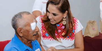 Salud Visual Gratuita: Jornada de Cirugías de Pterigión Transforma 300 Vidas en Quintana Roo