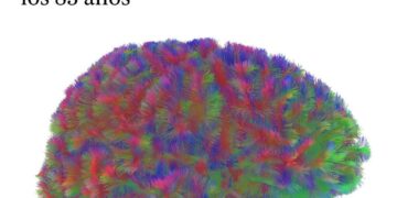 La Adolescencia Cerebral se Extiende Un Estudio Redefine la Madurez