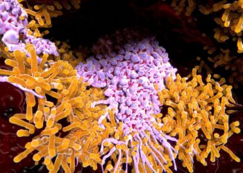 La Tuberculosis Sigue Siendo una Amenaza Mortal: Cobra Más de 1.2 Millones de Vidas al Año