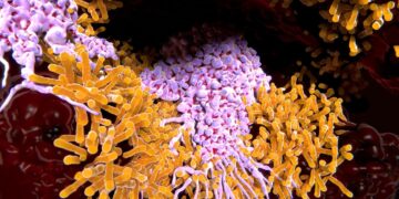 La Tuberculosis Sigue Siendo una Amenaza Mortal: Cobra Más de 1.2 Millones de Vidas al Año