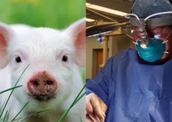 Trasplantes Avanza el Uso de Riñones de Cerdos en Humanos