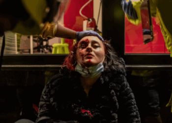 Un joven manifestante pierde la vista tras sufrir una agresión policial en Santa Ana