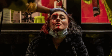 Un joven manifestante pierde la vista tras sufrir una agresión policial en Santa Ana