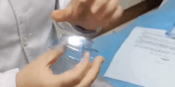 La nueva endoscopia capsular china revoluciona los exámenes de estómago