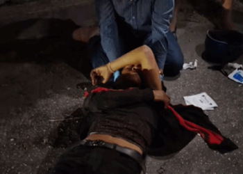 "Intentó hacer “caballito” en su motoneta y terminó estampado contra el pavimento"