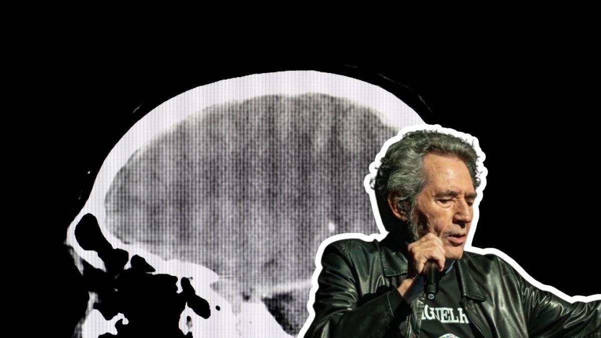 Miguel Ríos cancela conciertos por traumatismo craneal