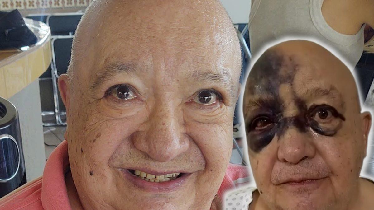 Luis de Alba hospitalizado tras sufrir desmayo y caída