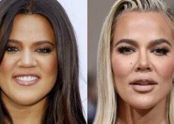 Khloé Kardashian revela sus procedimientos estéticos