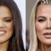Khloé Kardashian revela sus procedimientos estéticos