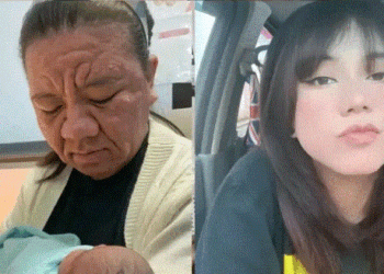 VIDEO🤰😱 Alergia gestacional transforma rostro de joven viral
