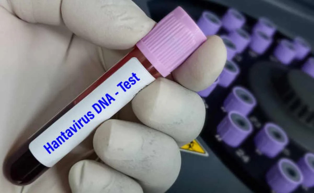 OMS declara fin del brote de hantavirus en crucero