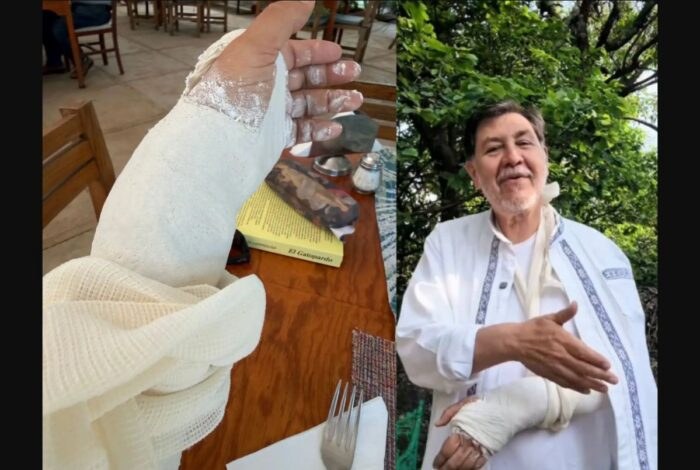 Fernández Noroña se fractura la muñeca en Tepoztlán