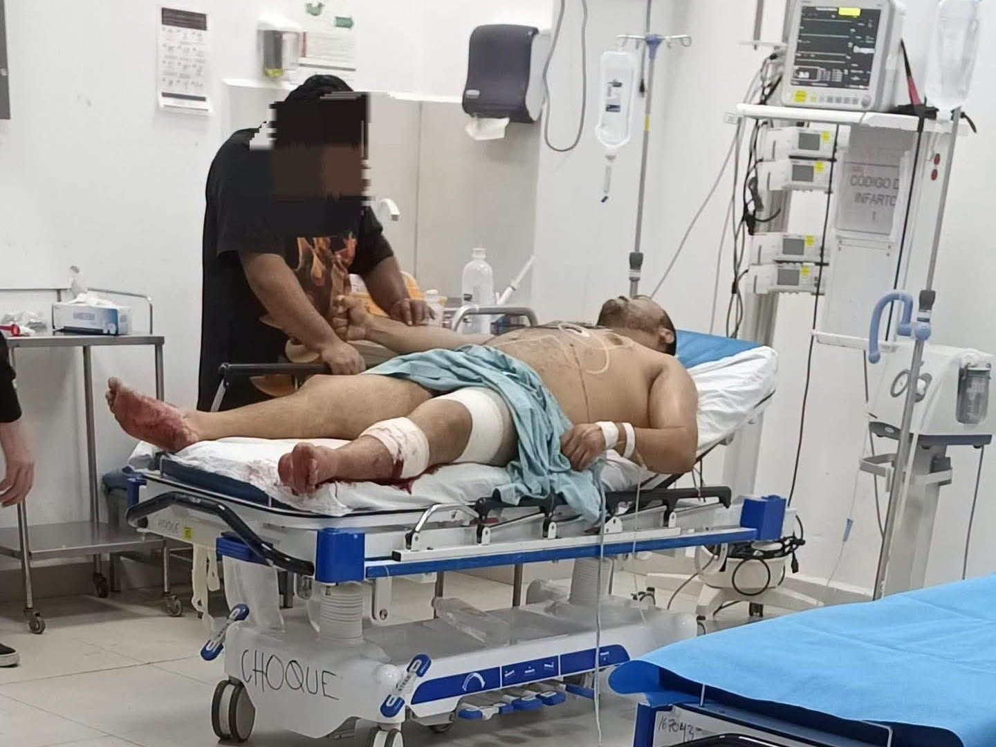 Balean a hombre en Santa Cecilia; está grave en hospital