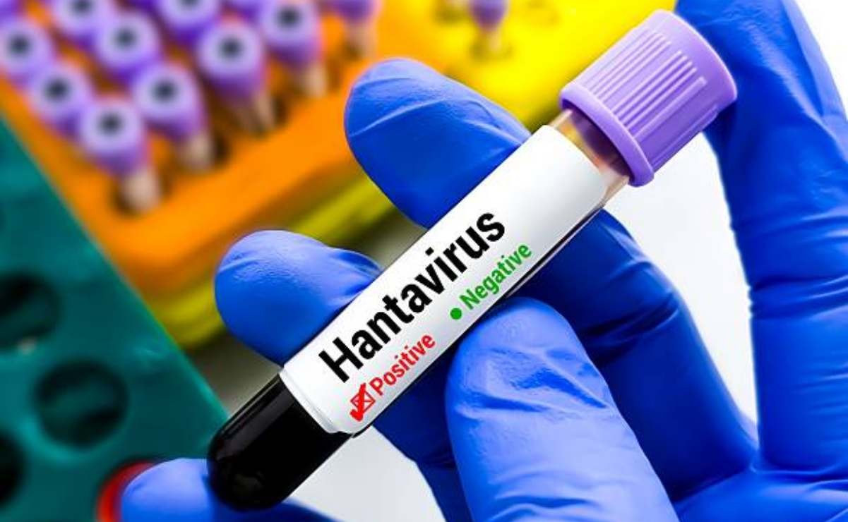 Turista en España da positivo a hantavirus tras viaje en Francia