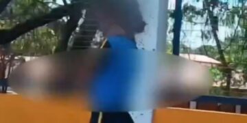 VIDEO; Ataque de abejas deja más de 100 picaduras a estudiante