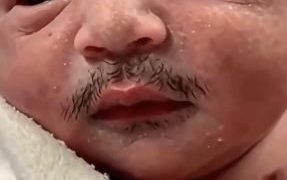 VIDEO; Bebé nace con bigote y aquí te explicamos por qué